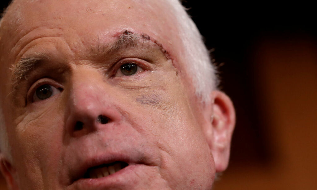 «Jeg har opplevd verre», skal kreftsyke John McCain ha sagt. Dette siktet han til