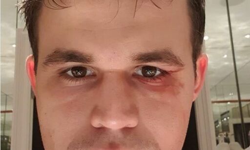 Slik går Carlsen inn i de avgjørende VM-partiene