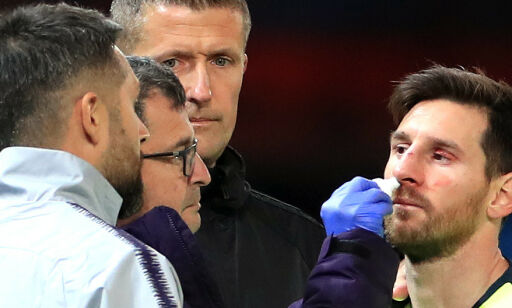 Messi albuet til blods